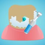 Dentist Bright – Dental Simulator: Teeth Clean